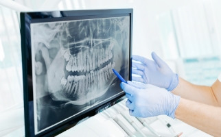 Dental Imaging