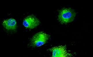 Fluorescence Resonance Energy Transfer (FRET)